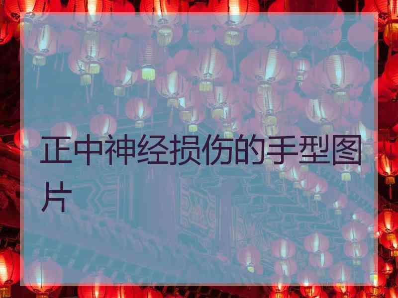 正中神经损伤的手型图片